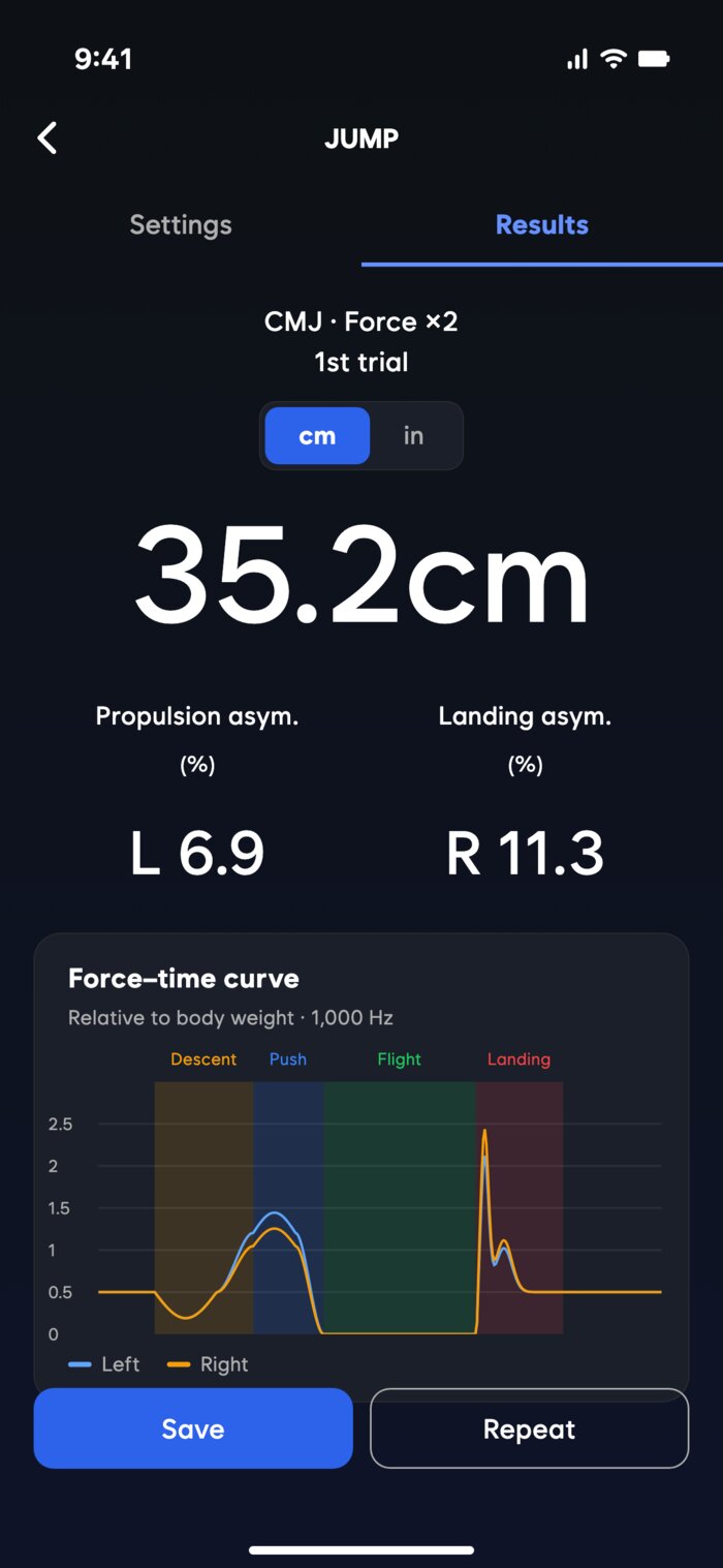 Force ×2 result: left and right force curves and asymmetry